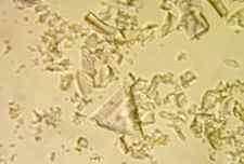 Flourite in plane polarised light. Note the equilateral triangular cleavage particle.